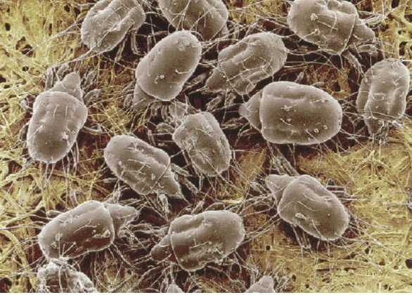 Allergies or Asthma affecting your sleep? | Urban Wool